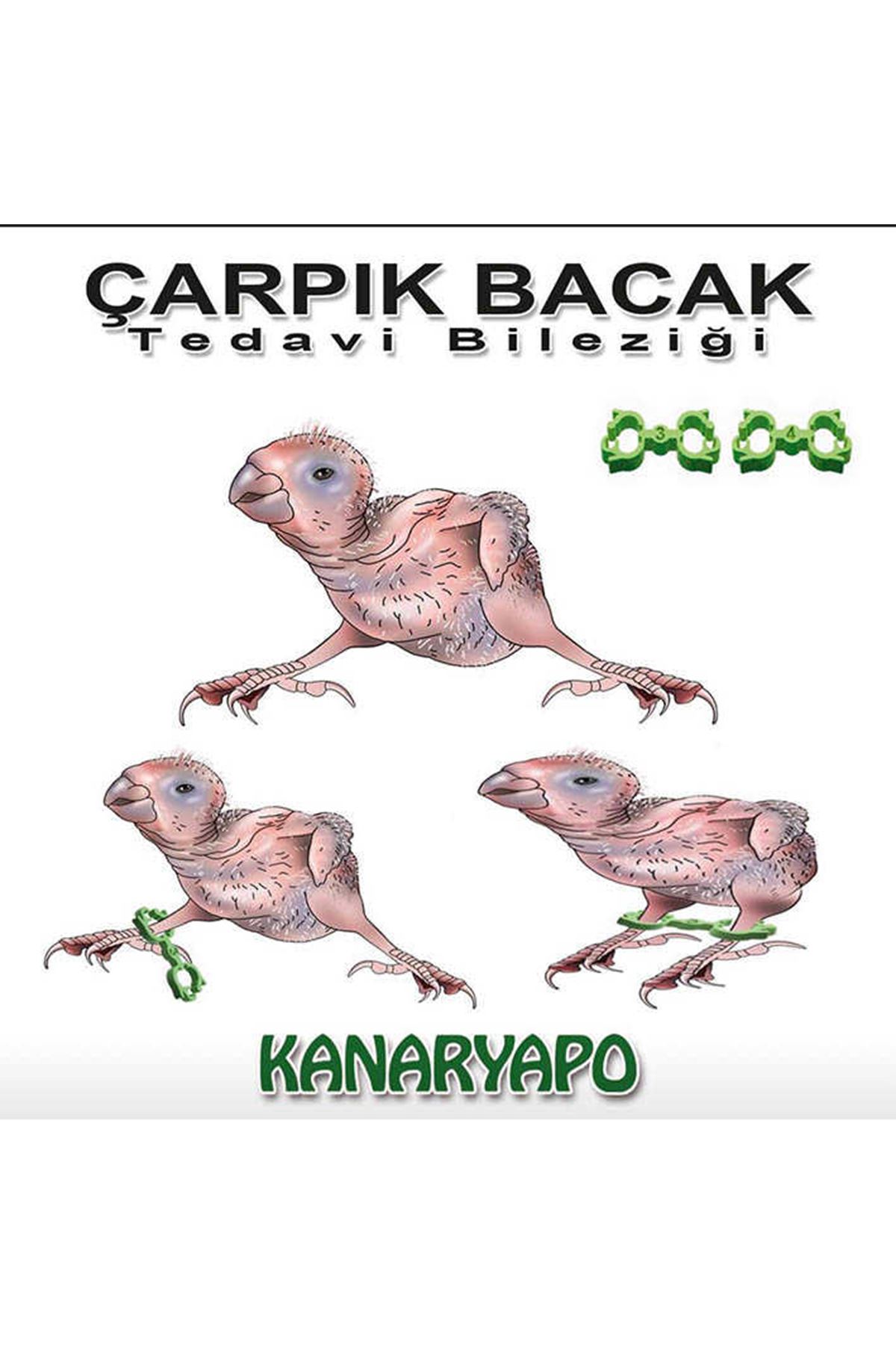 Muhabbet Çarpık Bacak Tedavi Bileziği No: 3-4